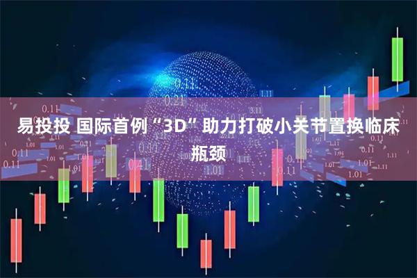 易投投 国际首例“3D”助力打破小关节置换临床瓶颈